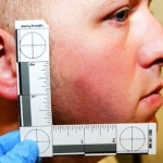 Ferguson-PO-Darren-Wilson-injuries-3-620×411