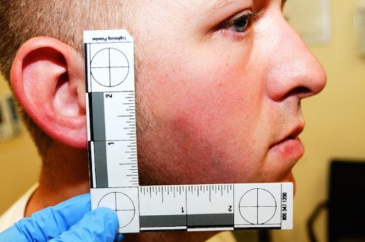 Photos taken of Officer Darren Wilson's "injuries." (Google Images)